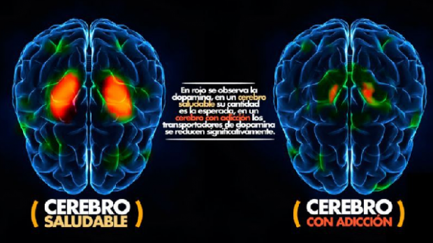 ¿Cómo Afectan Las Drogas Al Cerebro? | Erbol Digital Archivo